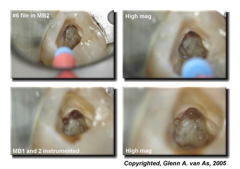 Endodontics_Page5 edited_resize.jpg